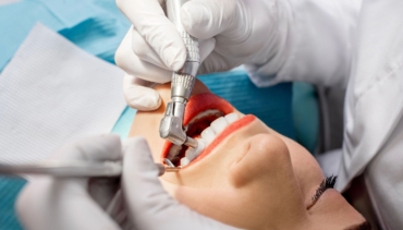 Cleaning and whitening