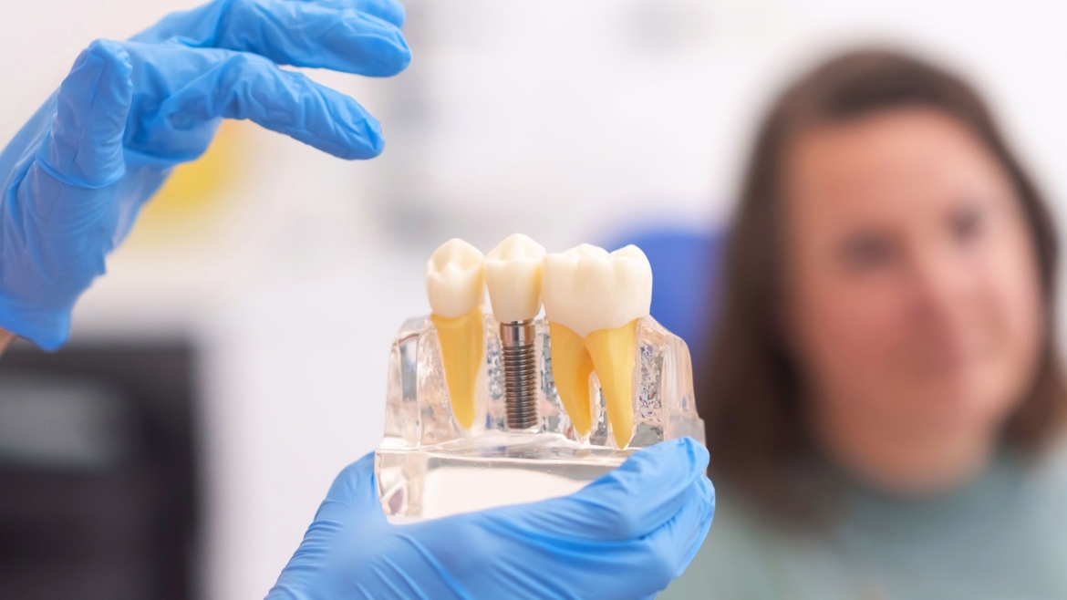 Implant dentistry